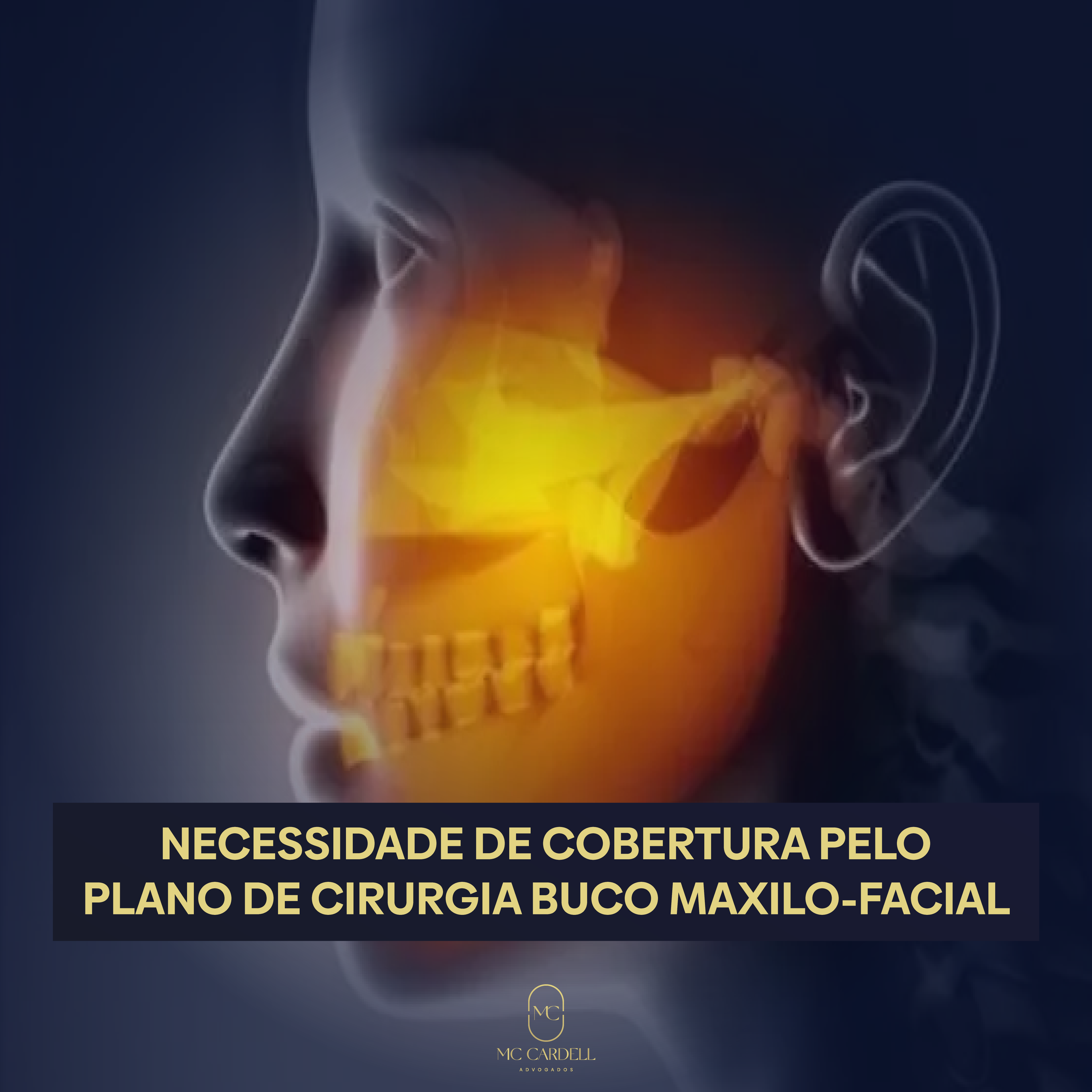 NECESSIDADE DE COBERTURA PELO PLANO DE CIRURGIA BUCO MAXILO-FACIAL